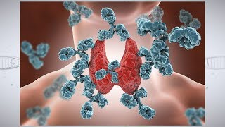 Understanding Autoimmune Thyroid Disease [upl. by Marchak]