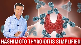 HASHIMOTOS THYROIDITIS Living with Autoimmune Disease [upl. by Ruckman]