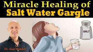 Miracle Healing of Salt Water Gargle  Dr Alan Mandell DC [upl. by Paloma]