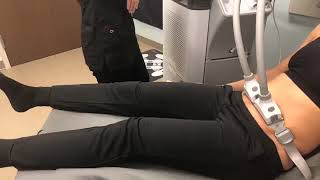 SculpSure Live Demo [upl. by Ailimat]