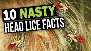 What Do Lice Eggs nits Look Like [upl. by Ecienaj]